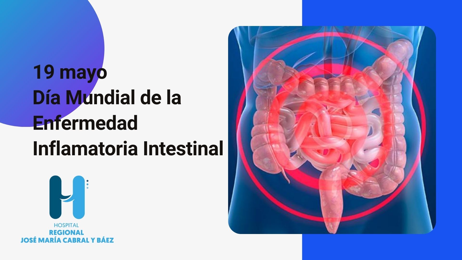 You are currently viewing Día Mundial de la Enfermedad Inflamatoria Intestinal